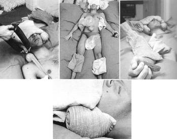 One of Lygia Clark's patients receiving treatment