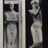 The Strand Statues for the British Medical Association, London (1907-1908)