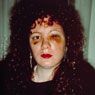 Nan One Month After Being Battered (1984)
