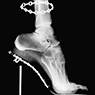 X-Ray, Van Cleef & Arpels, French Vogue (1994)